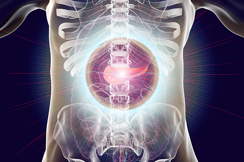 mfolfirinox pancreatic 